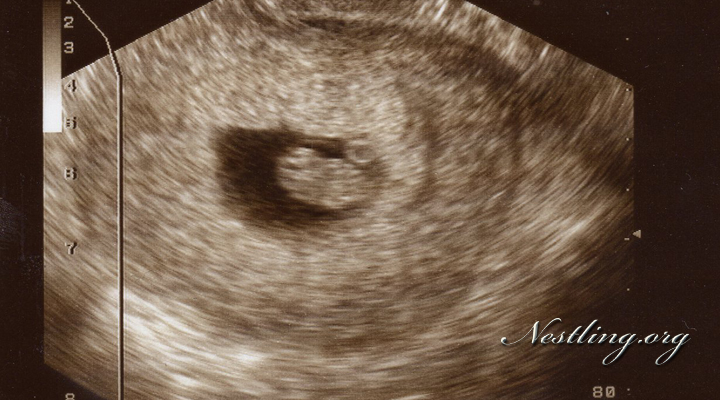 Schwangerschaftswoche ultraschall siebte 7 SSW